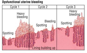 how to inject semaglutide in the thigh Wegovy Injection Site in the Thigh